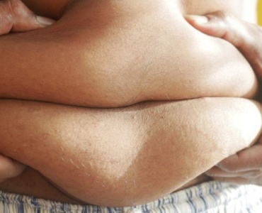 Top 10 Effective Workouts to Lose Belly Fat Fast