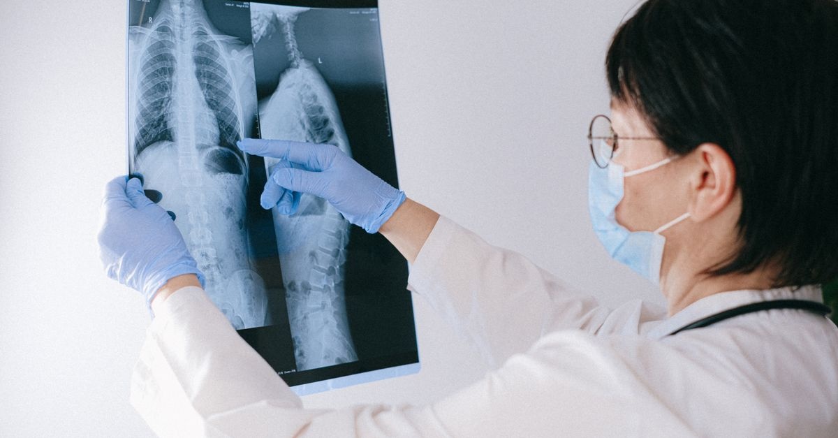 Effective Strategies for Osteoporosis Treatment: A Comprehensive Guide