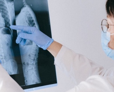 Effective Strategies for Osteoporosis Treatment: A Comprehensive Guide