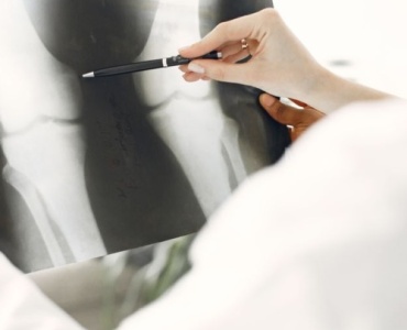 Innovative Approaches to Osteoporosis Treatment: What You Need to Know